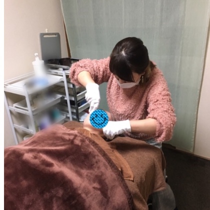 糸脱毛＋石膏パック